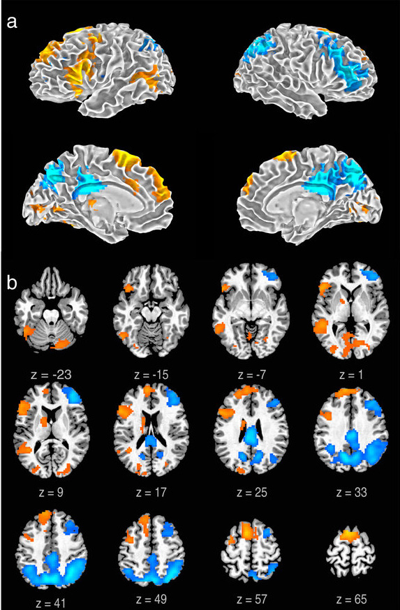 Orange represents increased activity, while blue represents decreased activity during improvisation.